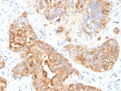 Immunohistochemistry-Paraffin: CEACAM5/CD66e Antibody (SPM330) - Azide and BSA Free [NBP2-47974]