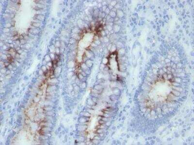 Immunohistochemistry-Paraffin: CEACAM5/CD66e Antibody (SPM506) - Azide and BSA Free [NBP2-47975]