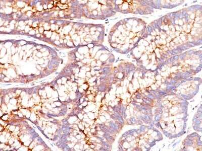 Immunohistochemistry-Paraffin: CEACAM5/CD66e Antibody (SPM541) - Azide and BSA Free [NBP2-34787]