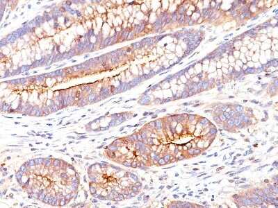 Immunohistochemistry-Paraffin: CEACAM5/CD66e Antibody (SPM551) - Azide and BSA Free [NBP2-34793]