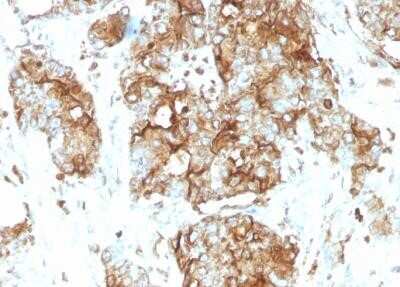 Immunohistochemistry-Paraffin: CEACAM5/CD66e Antibody (SPM584) - Azide and BSA Free [NBP2-34851]