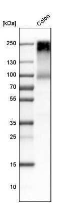 Western Blot: CEACAM5/CD66e Antibody [NBP1-85742]