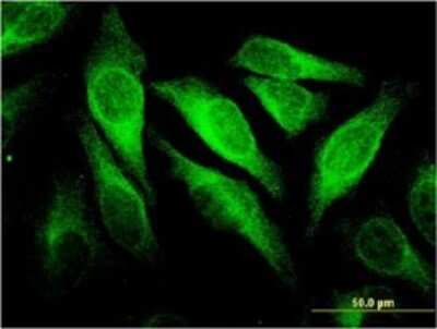 Immunocytochemistry/ Immunofluorescence: CEACAM6/CD66c Antibody (1G2) [H00004680-M02]