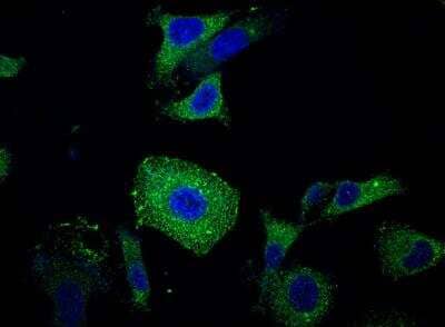 Immunocytochemistry/ Immunofluorescence: CEACAM6/CD66c Antibody (408) [NBP2-89669]