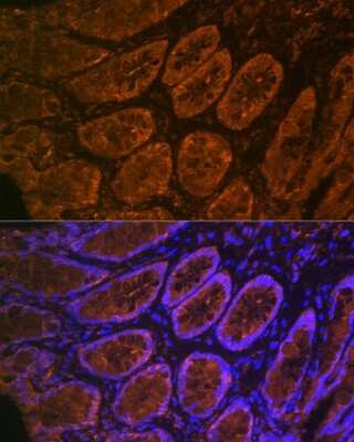 Immunocytochemistry/ Immunofluorescence: CEACAM6/CD66c Antibody (4Z3V7) [NBP3-16625]