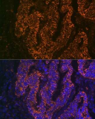 Immunocytochemistry/ Immunofluorescence: CEACAM6/CD66c Antibody (4Z3V7) [NBP3-16625]