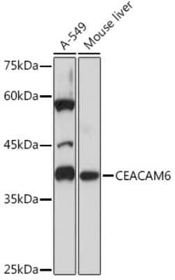 Western Blot: CEACAM6/CD66c Antibody (4Z3V7) [NBP3-16625]