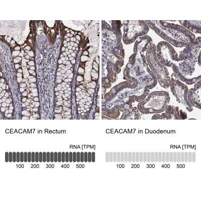 Immunohistochemistry-Paraffin: CEACAM7 Antibody [NBP3-17026]