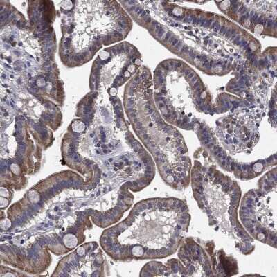 Immunohistochemistry-Paraffin: CEACAM7 Antibody [NBP3-17026]