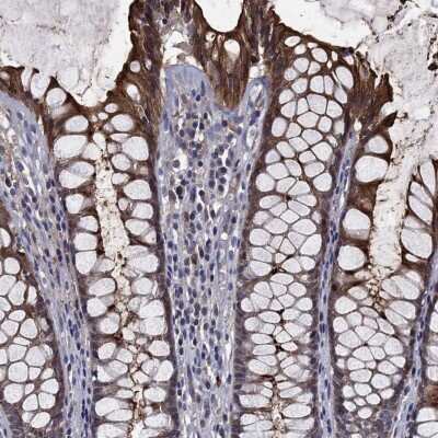 Immunohistochemistry-Paraffin: CEACAM7 Antibody [NBP3-17026]