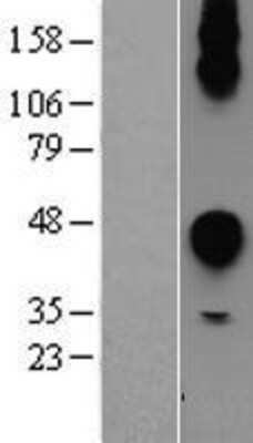 Western Blot: CEACAM7 Overexpression Lysate [NBP2-04321]