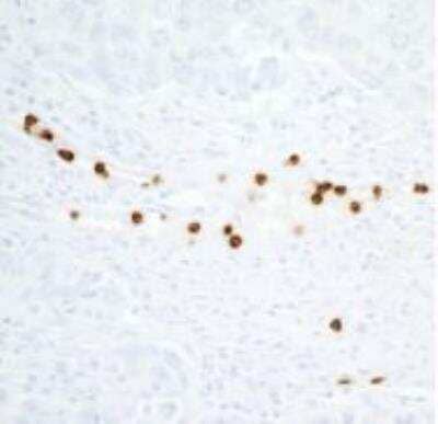 Immunohistochemistry-Paraffin: CEACAM8/CD66b Antibody (BLR111H) [NBP3-14700]