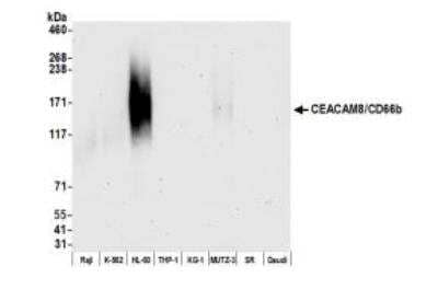 Western Blot: CEACAM8/CD66b Antibody (BLR111H) [NBP3-14700]