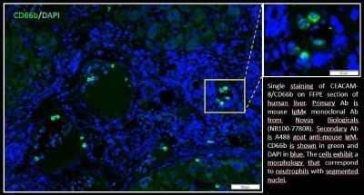 Immunohistochemistry: CEACAM8/CD66b Antibody (G10F5) - Azide and BSA Free [NBP2-80664]