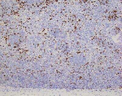 Immunohistochemistry-Paraffin: CEACAM8/CD66b Antibody (G10F5) [NB100-77808]