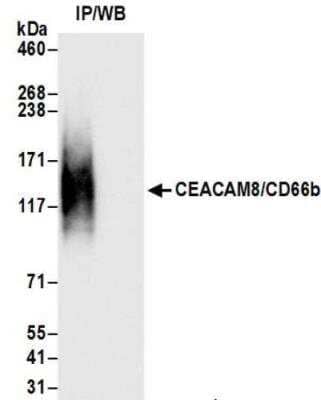 Immunoprecipitation: CEACAM8/CD66b Antibody (BLR111H) [NBP3-14700]