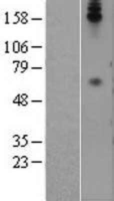 Western Blot: CEACAM8/CD66b Overexpression Lysate [NBP2-08173]