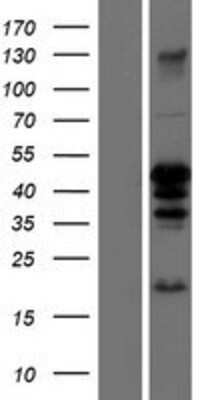 Western Blot: CEBP alpha Overexpression Lysate [NBP2-10582]