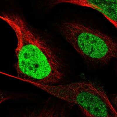 Immunocytochemistry/ Immunofluorescence: CEBP Beta Antibody [NBP2-56476]