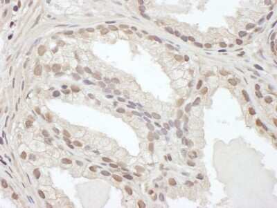 Immunohistochemistry-Paraffin: CEBP Beta Antibody [NBP1-46179]