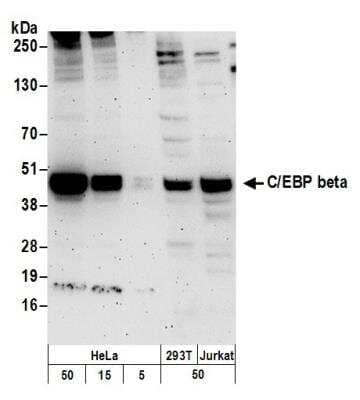 Western Blot: CEBP Beta Antibody [NBP1-46179]