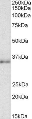Western Blot: CEBP Beta Antibody [NBP2-26206]