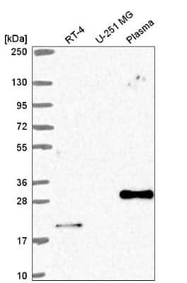 Western Blot: CEBP Beta Antibody [NBP2-57075]