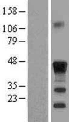 Western Blot: CEBP Beta Overexpression Lysate [NBL1-09074]