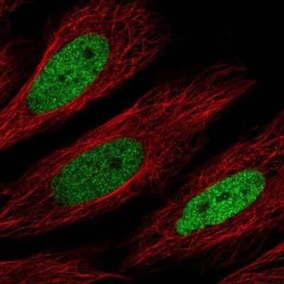 Immunocytochemistry/ Immunofluorescence: CEBP Delta Antibody [NBP2-56564]