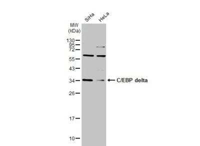 Western Blot: CEBP Delta Antibody [NBP2-21568]