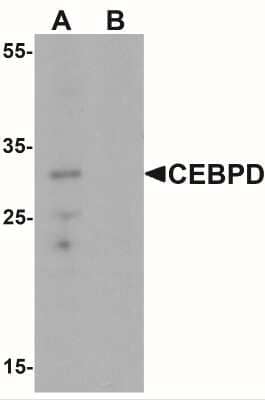 Western Blot: CEBP Delta AntibodyBSA Free [NBP2-41192]