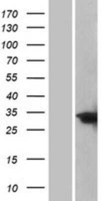 Western Blot: CEBP Delta Overexpression Lysate [NBP2-10485]