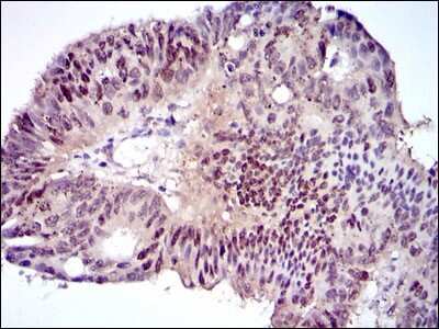 Immunohistochemistry: CEBP alpha Antibody (5B7) - BSA Free [NBP2-37497]