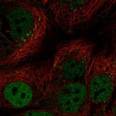 Immunocytochemistry/ Immunofluorescence: CEBP alpha Antibody [NBP2-56909]