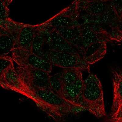 Immunocytochemistry/ Immunofluorescence: CEBP alpha Antibody [NBP2-57544]