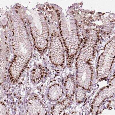 Immunohistochemistry-Paraffin: CEBP alpha Antibody [NBP2-39044]