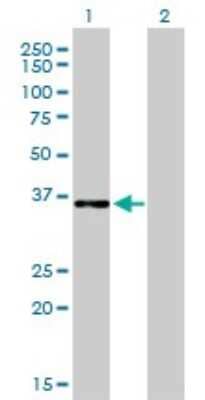 Western Blot: CEBP epsilon Antibody (7A4) [H00001053-M01]