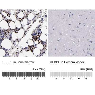 Immunohistochemistry-Paraffin: CEBP epsilon Antibody [NBP1-85446]