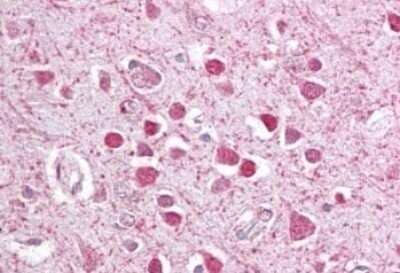 Immunohistochemistry-Paraffin: CEBP gamma Antibody [NBP1-36944]