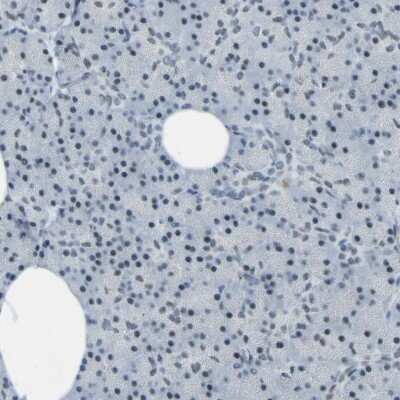 Immunohistochemistry-Paraffin: CEBP gamma Antibody [NBP1-89742]