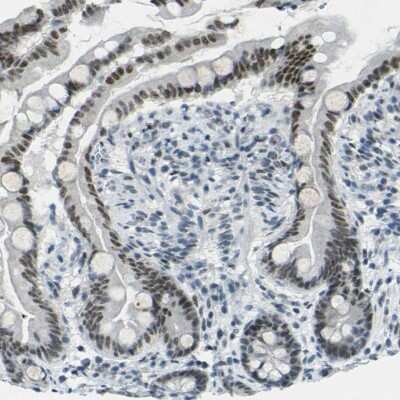 Immunohistochemistry-Paraffin: CEBP gamma Antibody [NBP1-89742]
