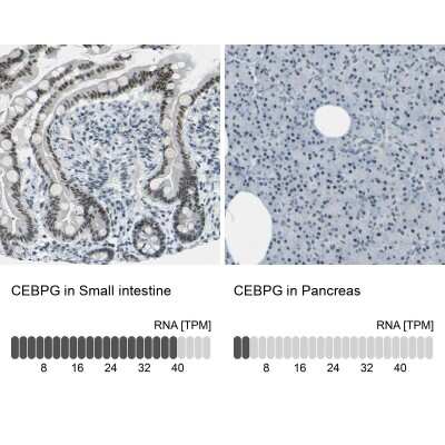 Immunohistochemistry-Paraffin: CEBP gamma Antibody [NBP1-89742]