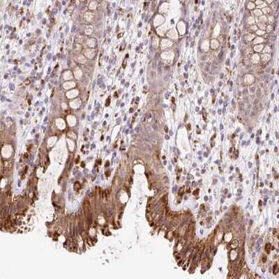 Immunohistochemistry: CEBPZOS Antibody [NBP2-47513]