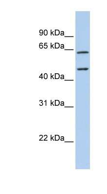 Western Blot: Adenosine Deaminase 2/CECR1 Antibody [NBP1-59343]