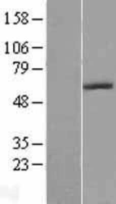 Western Blot: Adenosine Deaminase 2/CECR1 Overexpression Lysate [NBL1-09078]