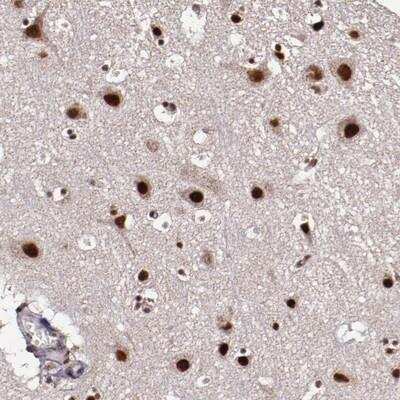 Immunohistochemistry-Paraffin: CECR2 Antibody [NBP1-81378]