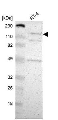 Western Blot: CECR2 Antibody [NBP1-81378]