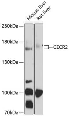 Western Blot: CECR2 AntibodyBSA Free [NBP2-92002]