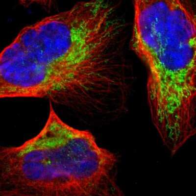 Immunocytochemistry/ Immunofluorescence: CECR5 Antibody [NBP1-86136]