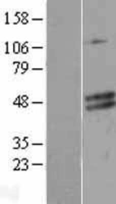 Western Blot: CECR5 Overexpression Lysate [NBL1-09079]